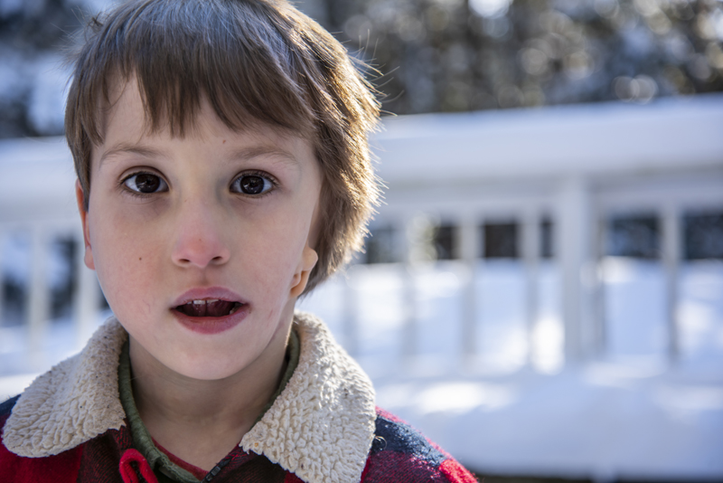 Hayden Libby poses for a photo at his home in Waldoboro on Saturday, Dec. 19. Libby was born with hemifacial microsomia, a genetic defect that caused the the left side of his face to be less developed than the right. (Bisi Cameron Yee photo)