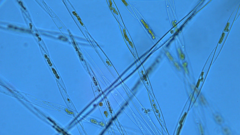 Light microscopy of Pseudo-nitzschia australis cells from the 2016 bloom event in the Gulf of Maine. Cells were collected in Englishman Bay during a "Rapid Response" cruise in October 2016. (Photo courtesy P. D. Countway, Bigelow Laboratory for Ocean Sciences)
